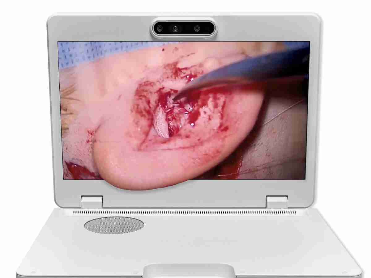 达擎之＂Heads-up 3D显微手术显示系统＂，，整合4K裸眼3D显示及眼球追踪系统，，，，具备快速追踪人眼移动位置功能，，，减轻医师长时间维持固定姿势的负担，，，让医师能有更宽广清晰的3D立体视野及更舒适的姿势来执行手术。。。。